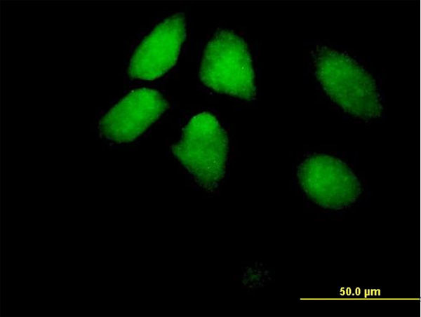 HIRA Antibody in Immunocytochemistry (ICC/IF)