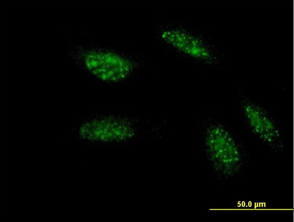 TWIST1 Antibody in Immunocytochemistry (ICC/IF)