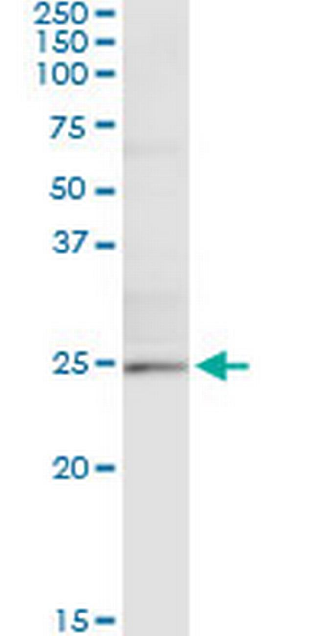 TWIST1 Antibody in Immunoprecipitation (IP)