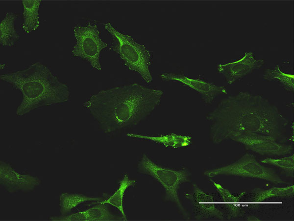 TXK Antibody in Immunocytochemistry (ICC/IF)