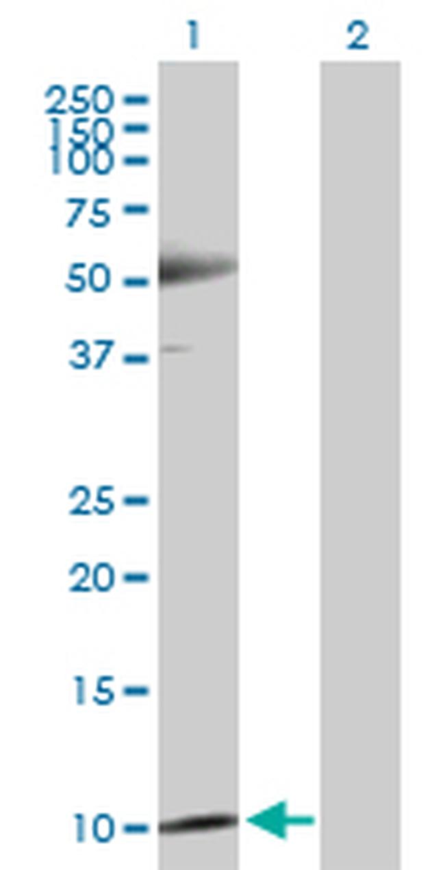 TXN Antibody in Western Blot (WB)