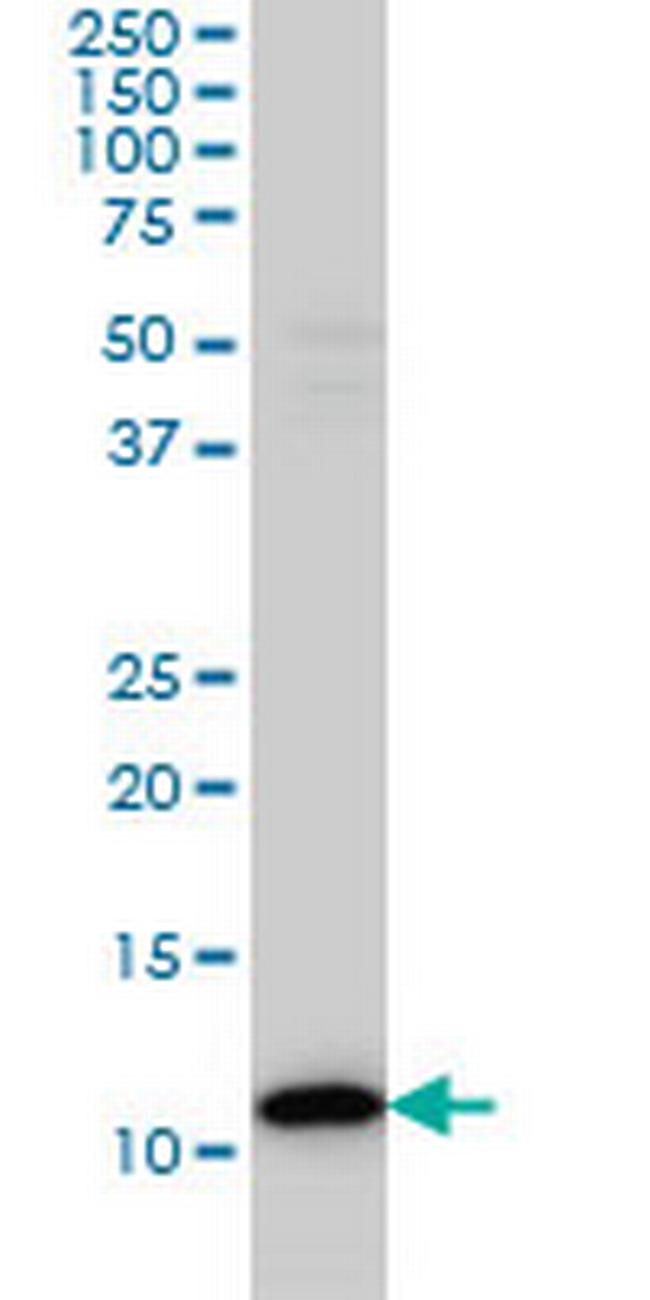TXN Antibody in Western Blot (WB)