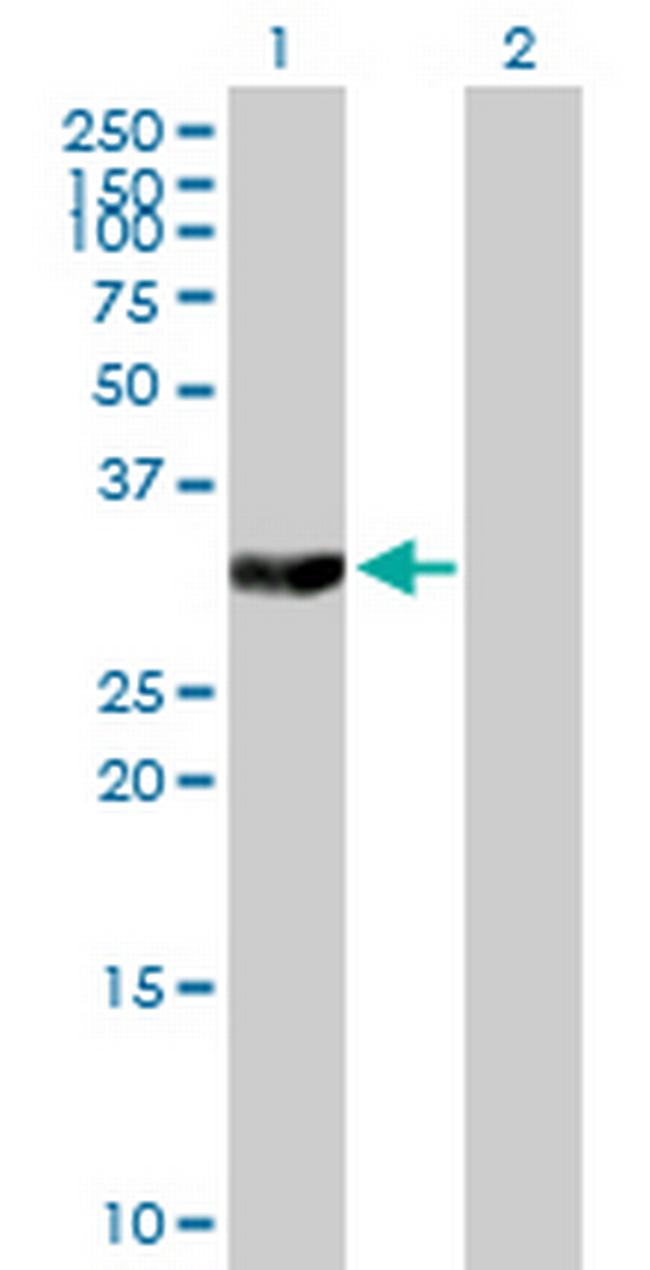 TYMS Antibody in Western Blot (WB)