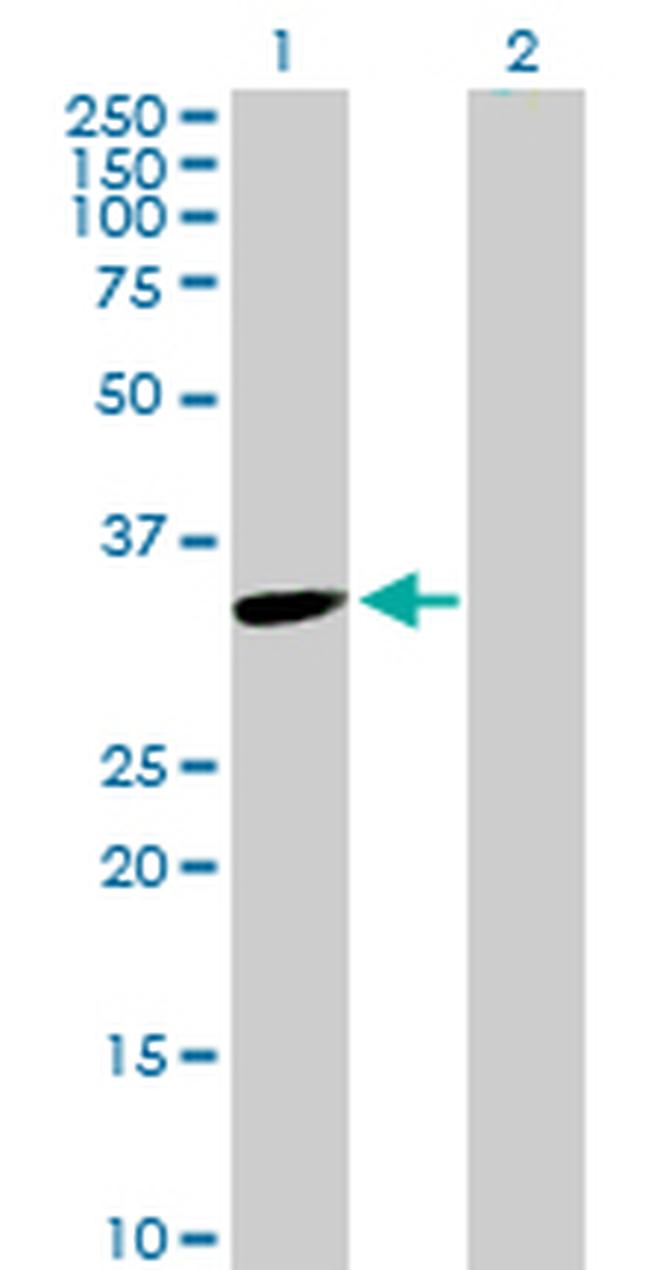 TYMS Antibody in Western Blot (WB)