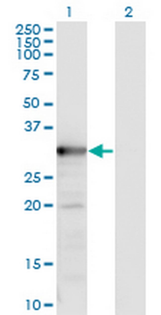 TYMS Antibody in Western Blot (WB)
