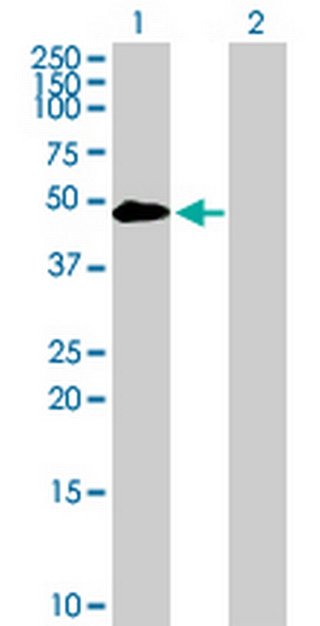 TYR Antibody in Western Blot (WB)