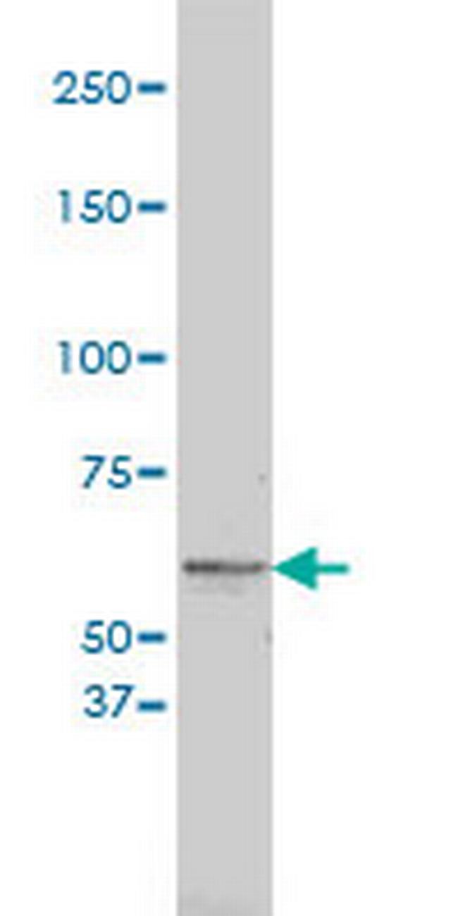 TYR Antibody in Western Blot (WB)