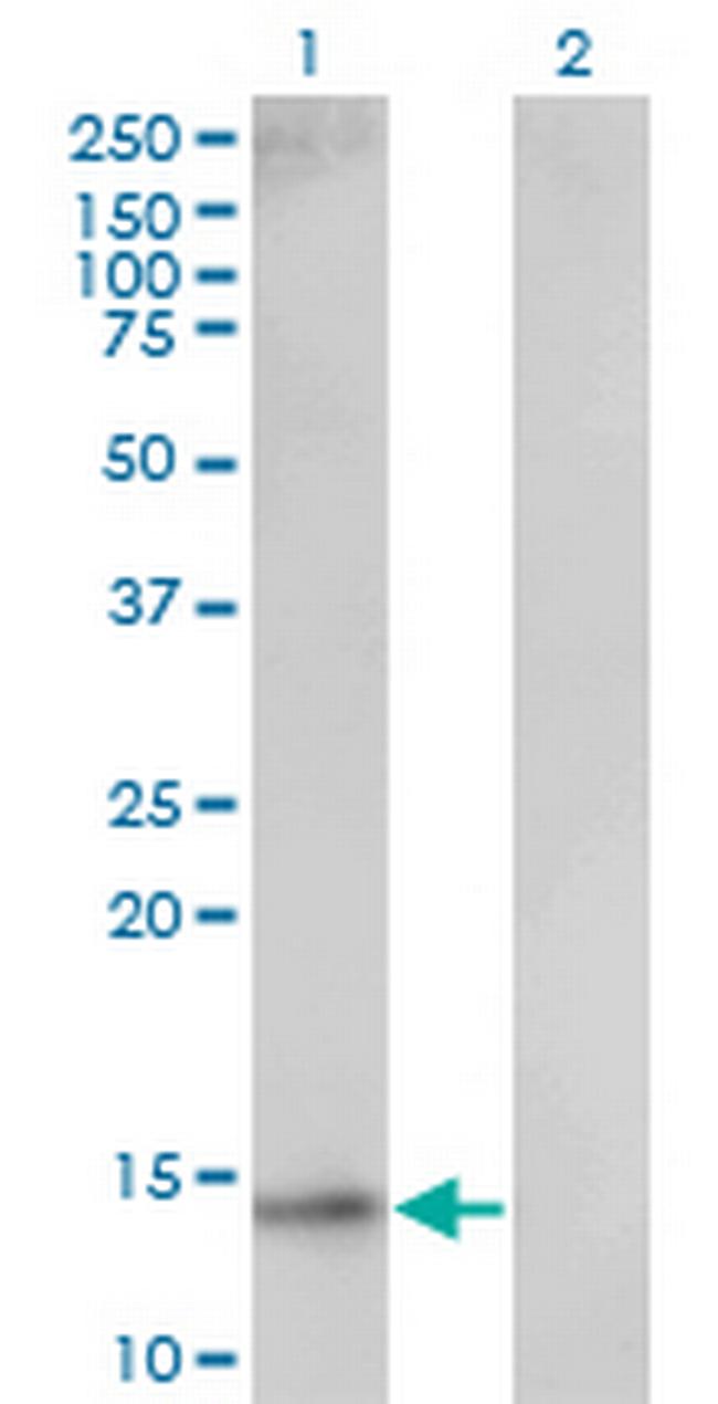 UBE2D1 Antibody in Western Blot (WB)