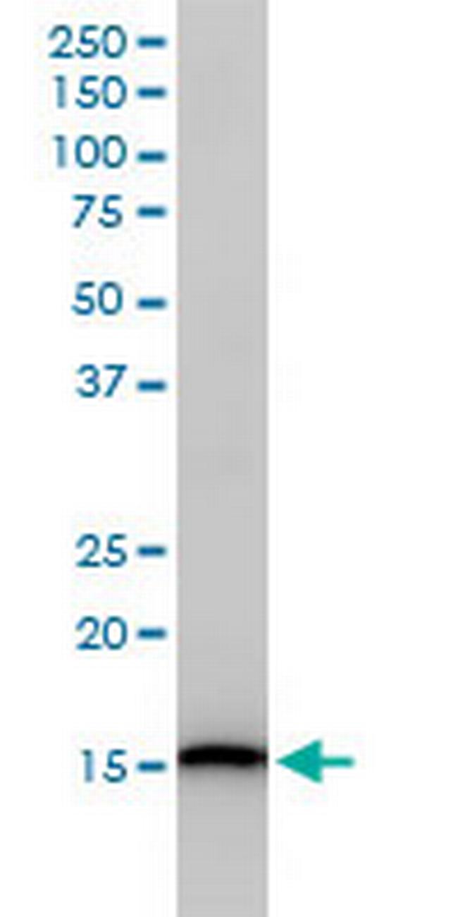 UBE2D3 Antibody in Western Blot (WB)