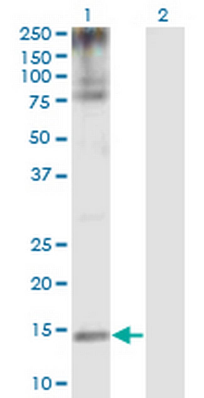 SUMO1 Antibody in Western Blot (WB)