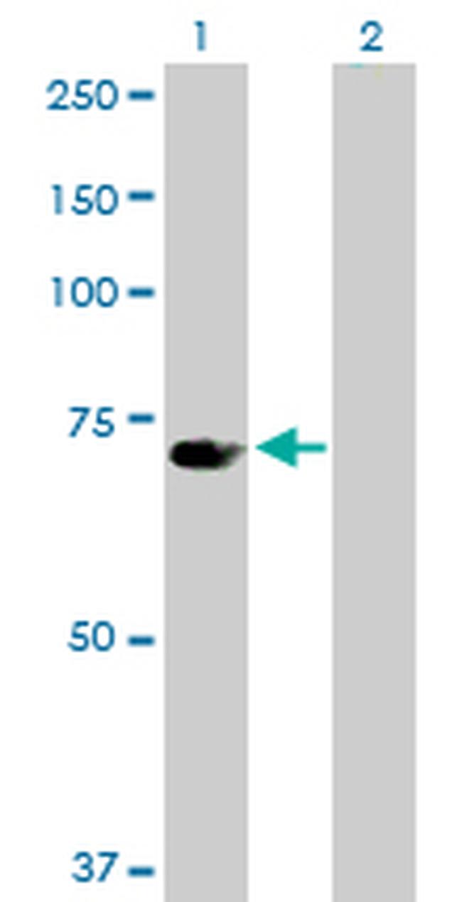 UBP1 Antibody in Western Blot (WB)