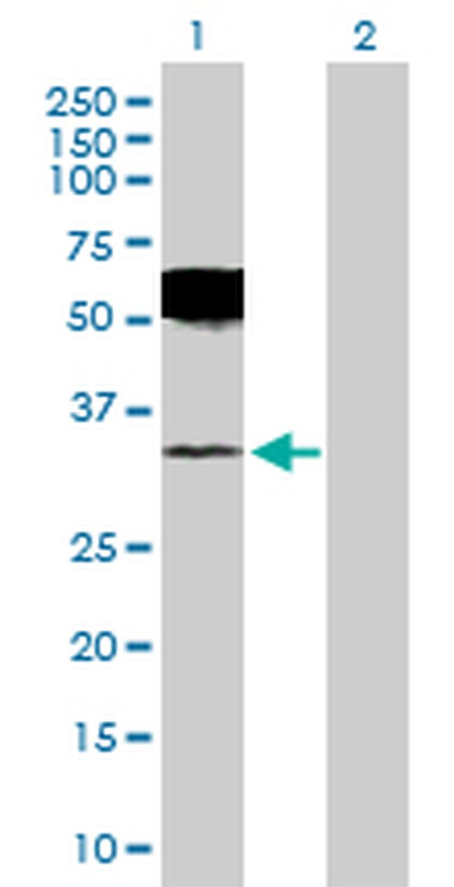 UCHL1 Antibody in Western Blot (WB)