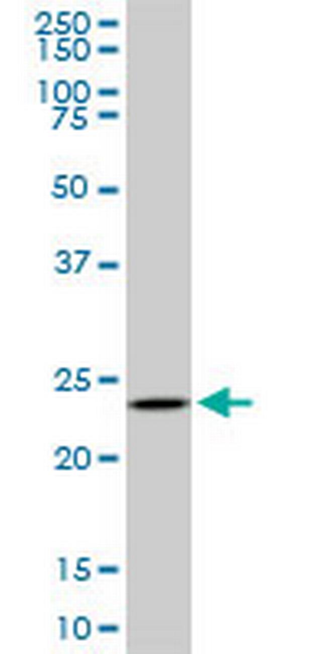 UCHL3 Antibody in Western Blot (WB)
