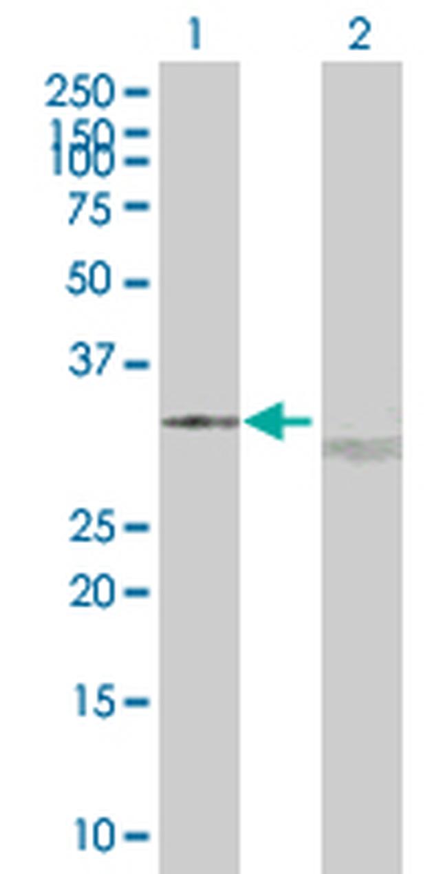 UCP2 Antibody in Western Blot (WB)