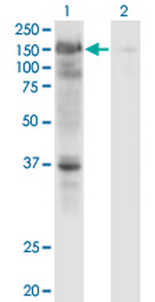 USP4 Antibody in Western Blot (WB)