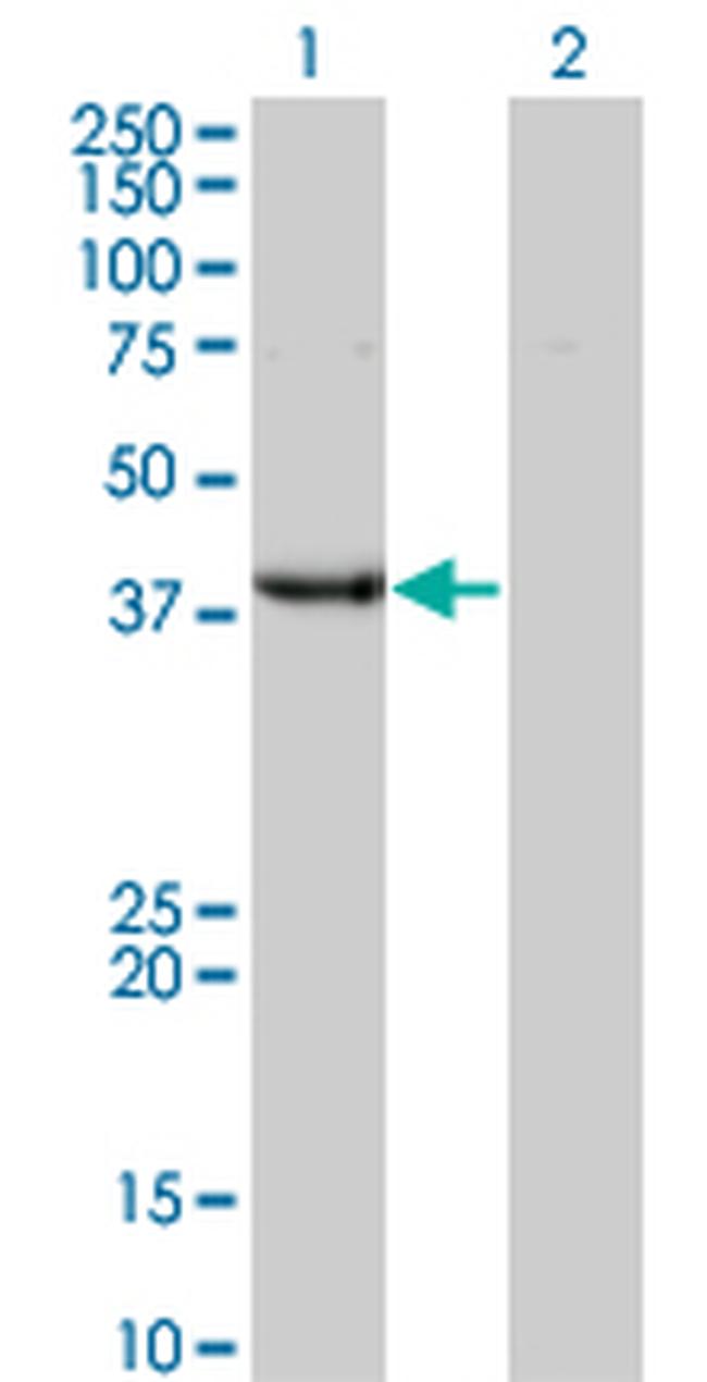 UROD Antibody in Western Blot (WB)