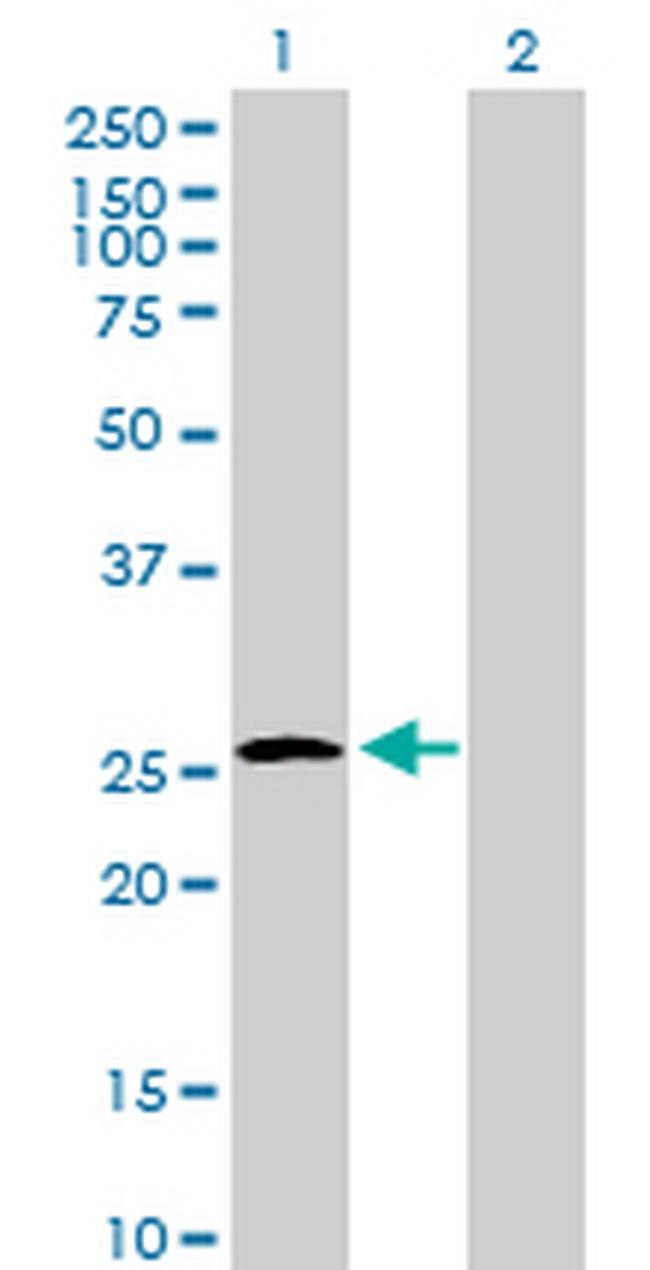 UROS Antibody in Western Blot (WB)