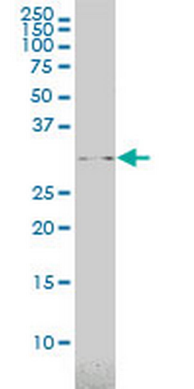 USF1 Antibody in Western Blot (WB)