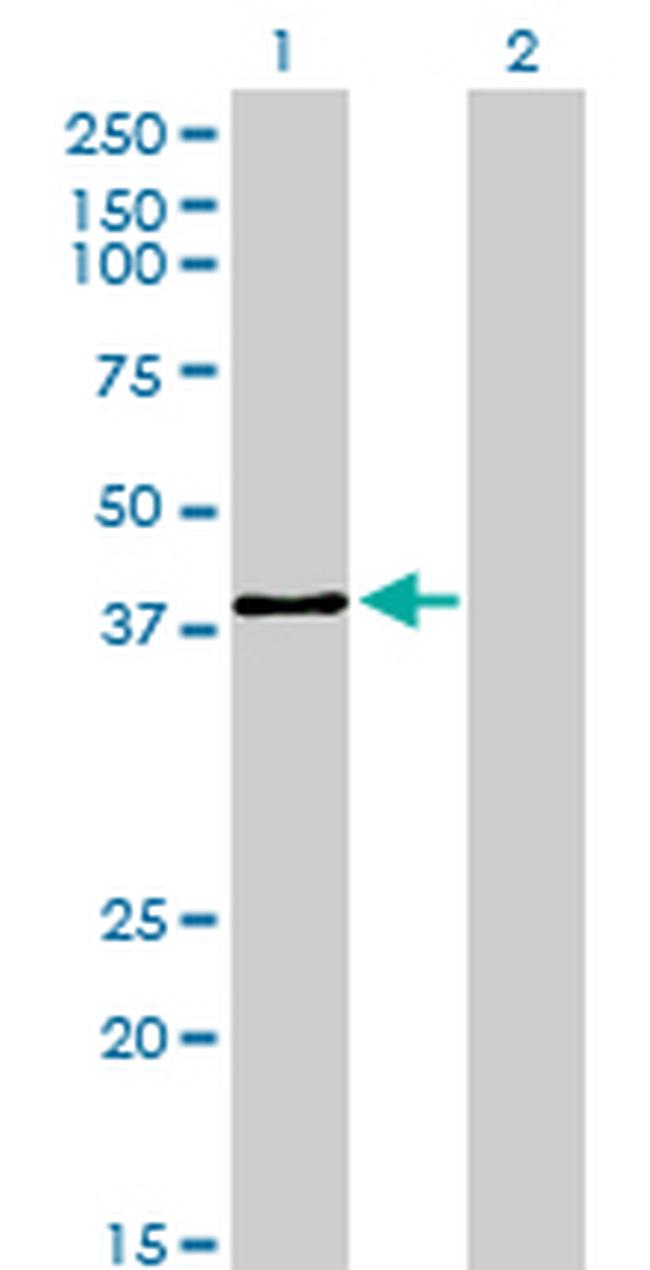 USF2 Antibody in Western Blot (WB)