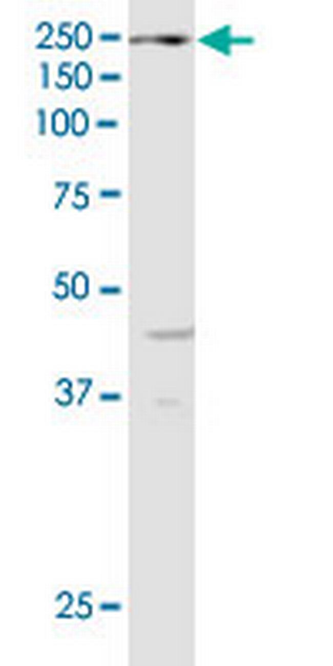 KDM6A Antibody in Western Blot (WB)