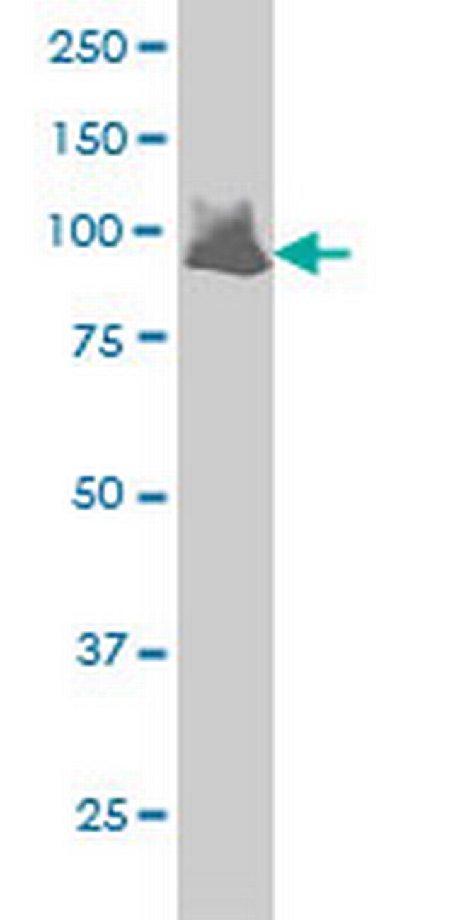 VAV1 Antibody in Western Blot (WB)