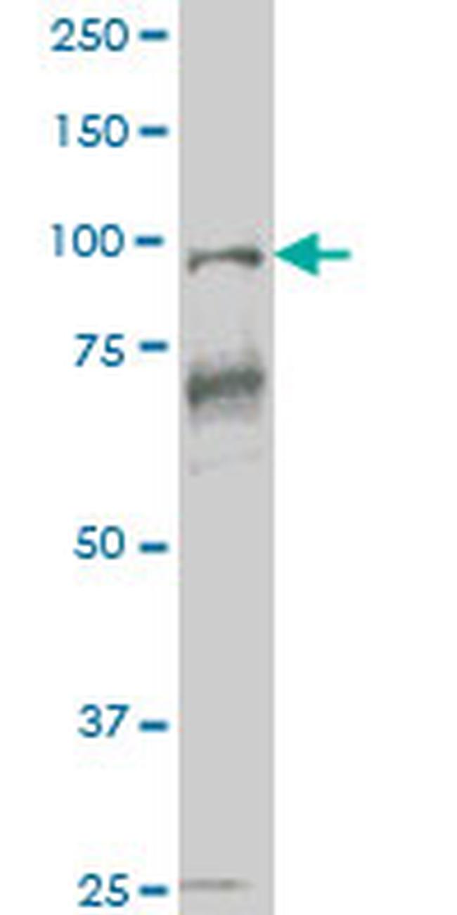 VAV1 Antibody in Western Blot (WB)