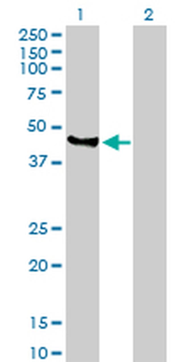 VIL1 Antibody in Western Blot (WB)