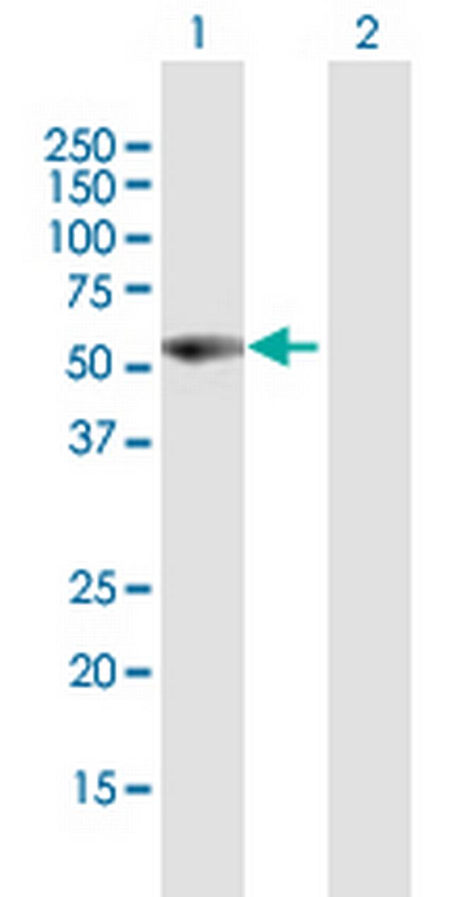 VIM Antibody in Western Blot (WB)
