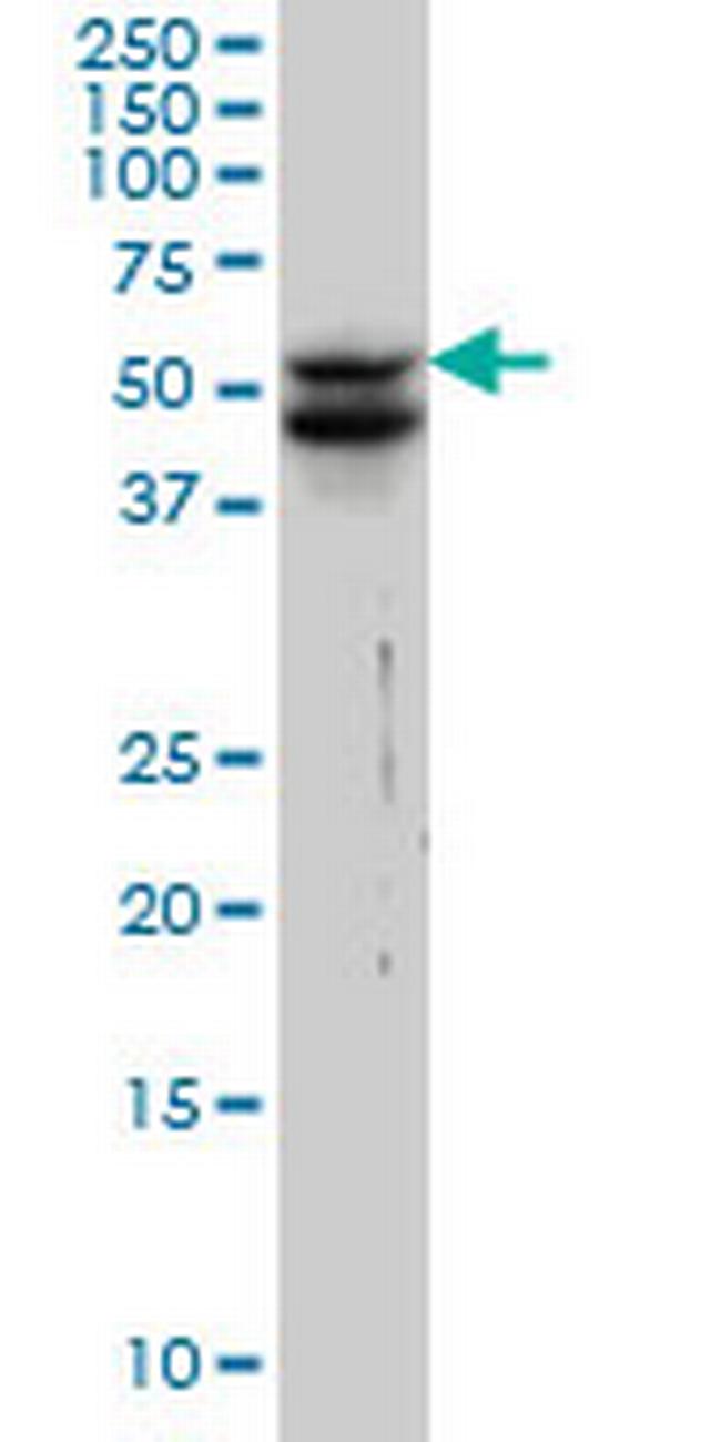 VIM Antibody in Western Blot (WB)