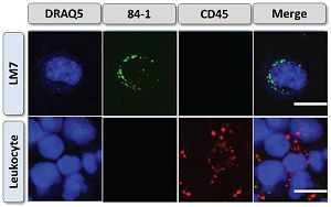 Cell-Surface Vimentin (CSV) Antibody in Immunocytochemistry (ICC/IF)