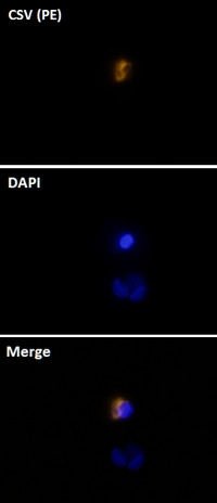 Cell-Surface Vimentin (CSV) Antibody in Immunocytochemistry (ICC/IF)
