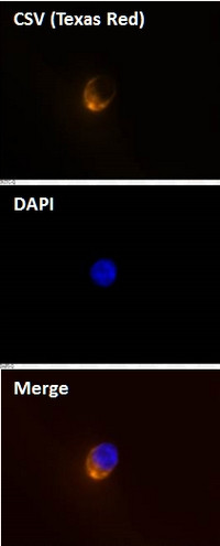 Cell-Surface Vimentin (CSV) Antibody in Immunocytochemistry (ICC/IF)