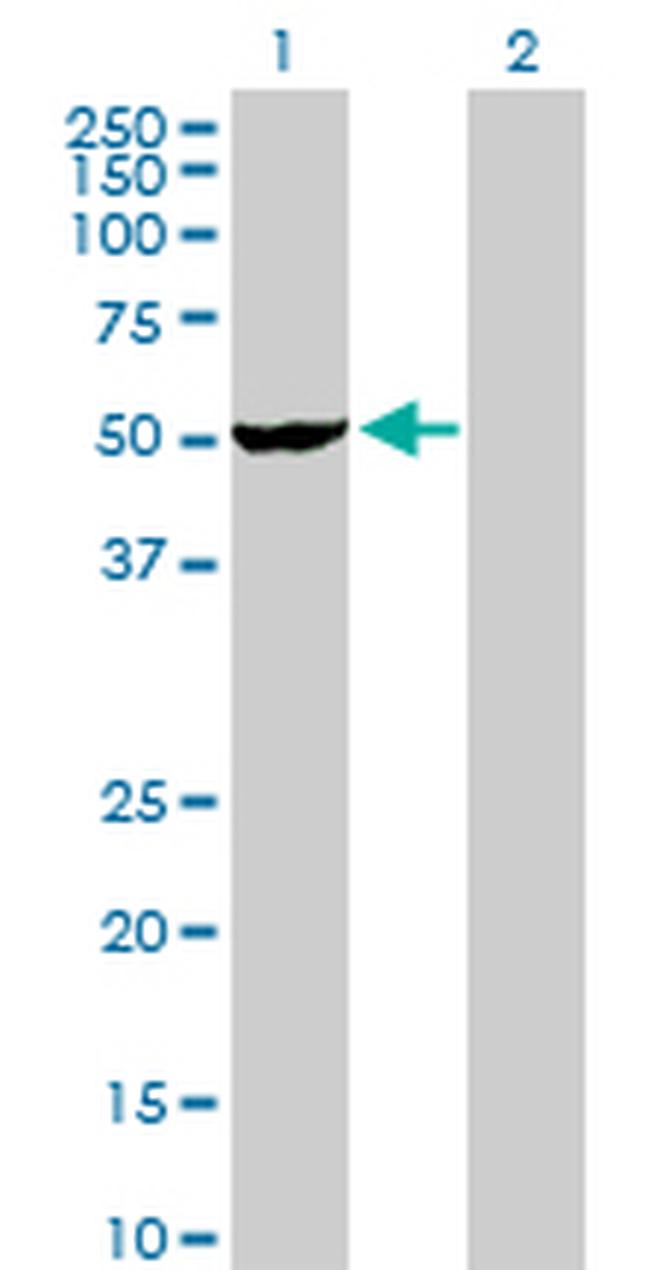VRK2 Antibody in Western Blot (WB)
