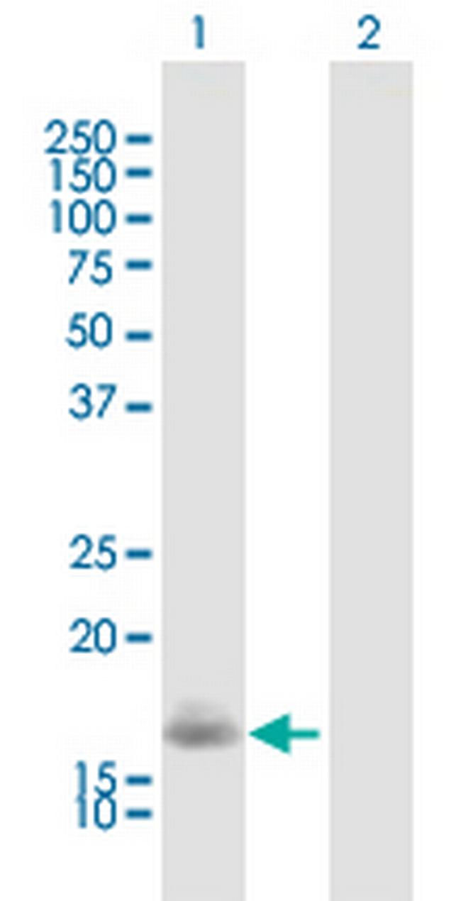 VSNL1 Antibody in Western Blot (WB)