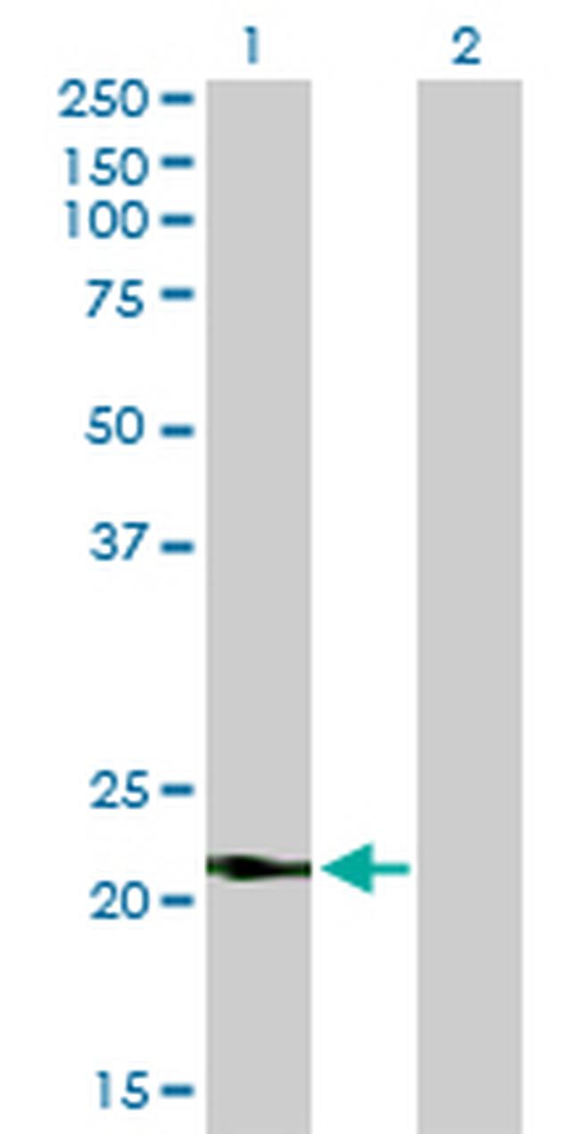 VSNL1 Antibody in Western Blot (WB)