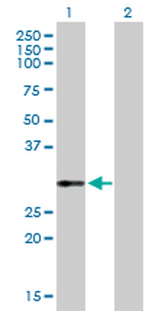 VWF Antibody in Western Blot (WB)