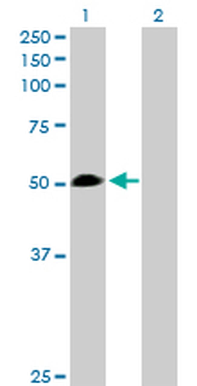 WARS Antibody in Western Blot (WB)