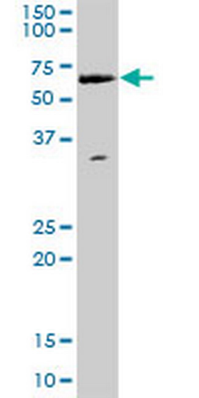 WHSC2 Antibody in Western Blot (WB)