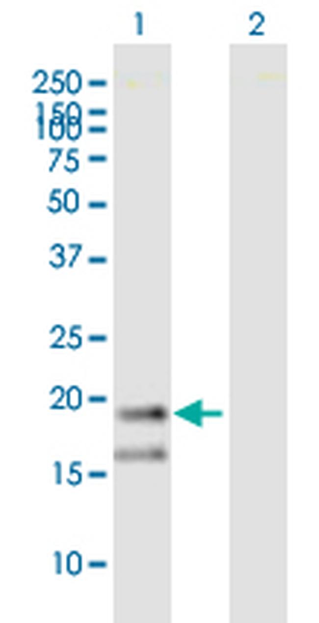 WRB Antibody in Western Blot (WB)