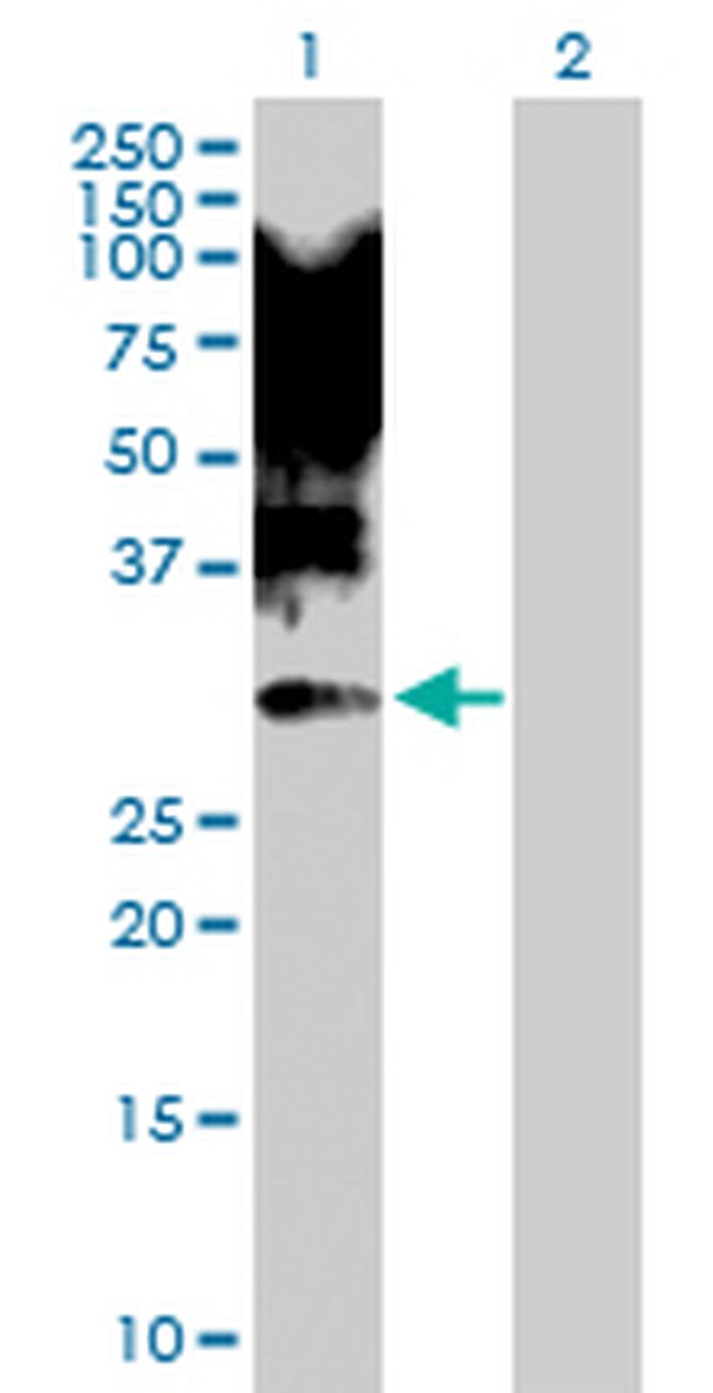 XBP1 Antibody in Western Blot (WB)