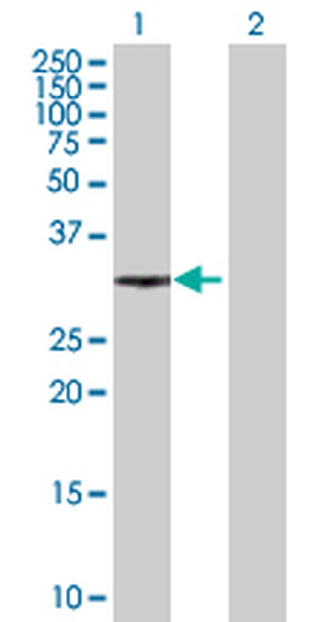 XRCC2 Antibody in Western Blot (WB)