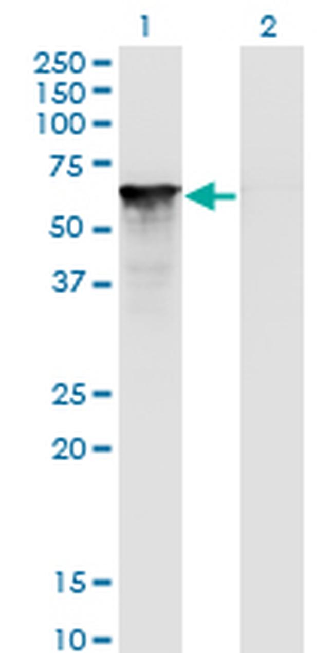 SF1 Antibody in Western Blot (WB)