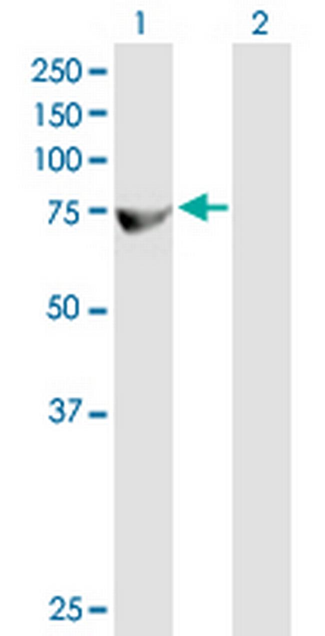ZFP37 Antibody in Western Blot (WB)
