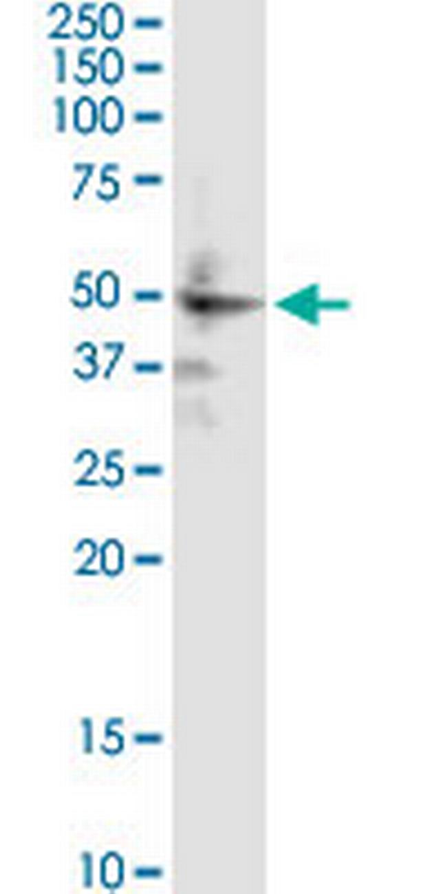 ZIC1 Antibody in Western Blot (WB)