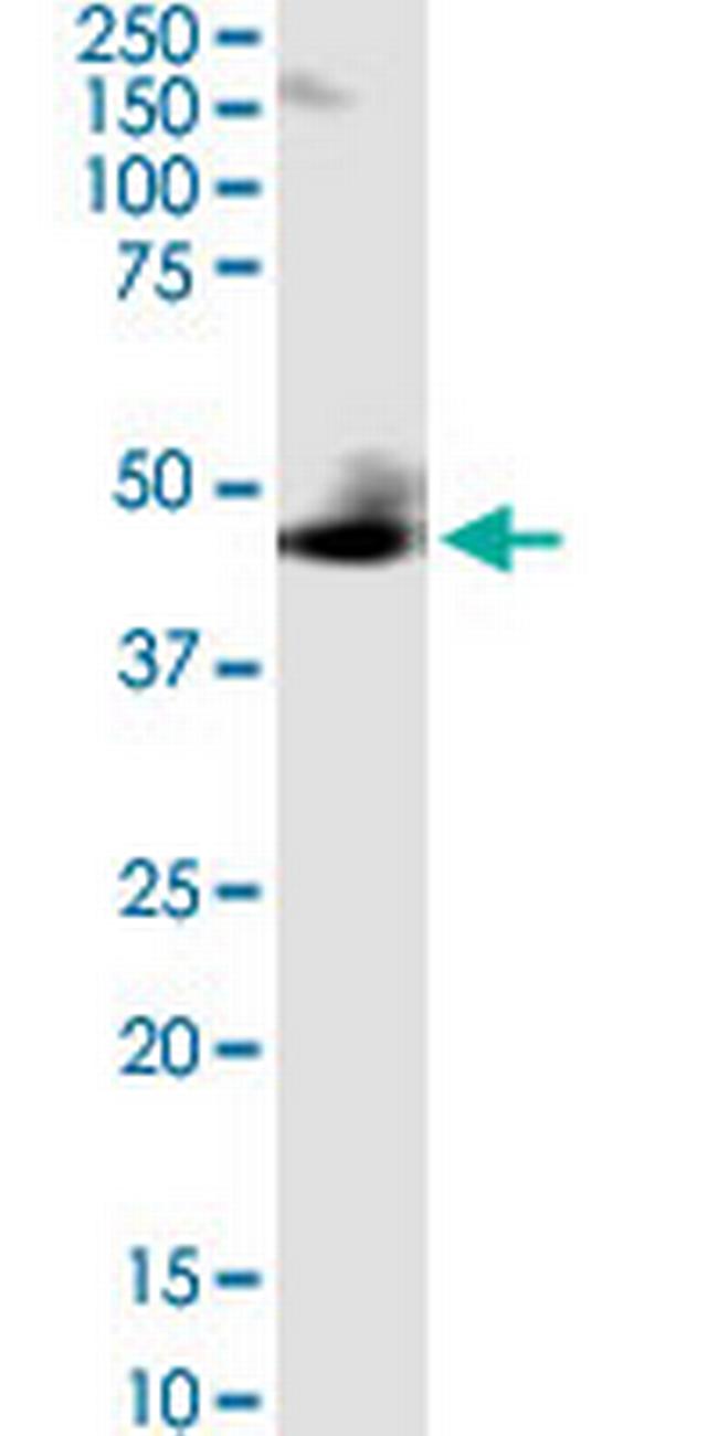 ZIC1 Antibody in Western Blot (WB)