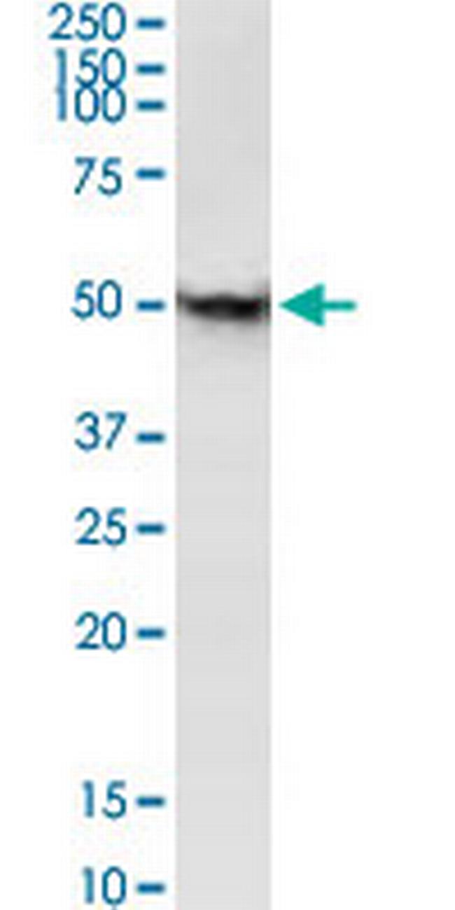 ZIC1 Antibody in Western Blot (WB)