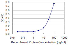 ZIC3 Antibody in ELISA (ELISA)