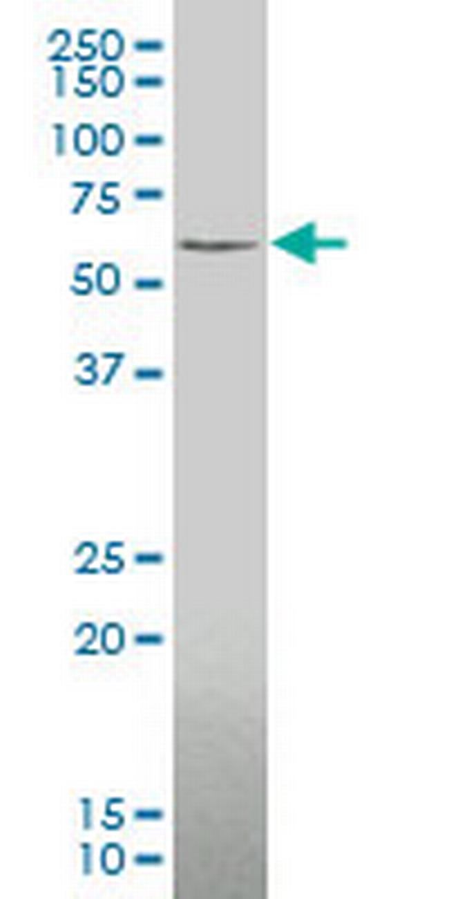 ZIC3 Antibody in Western Blot (WB)