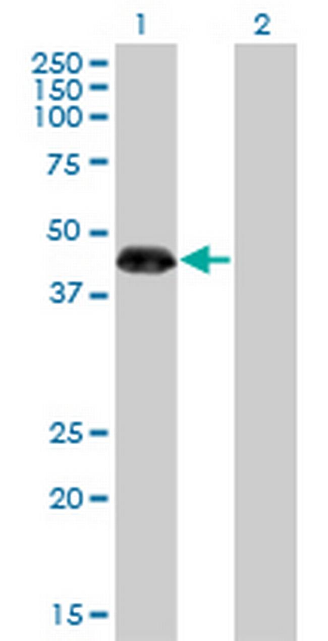 ZNF3 Antibody in Western Blot (WB)