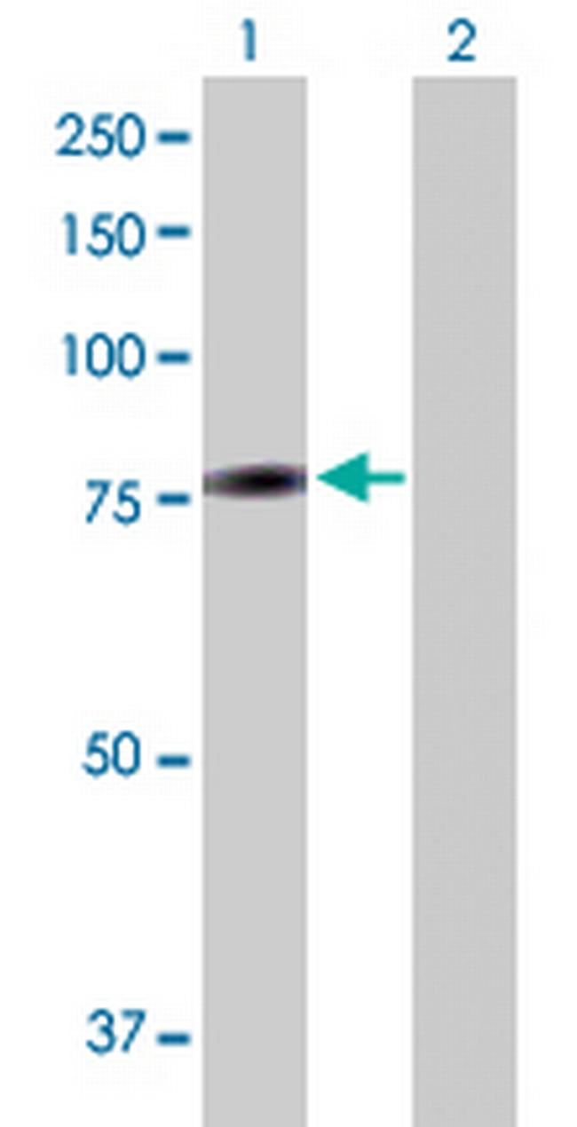 ZNF7 Antibody in Western Blot (WB)